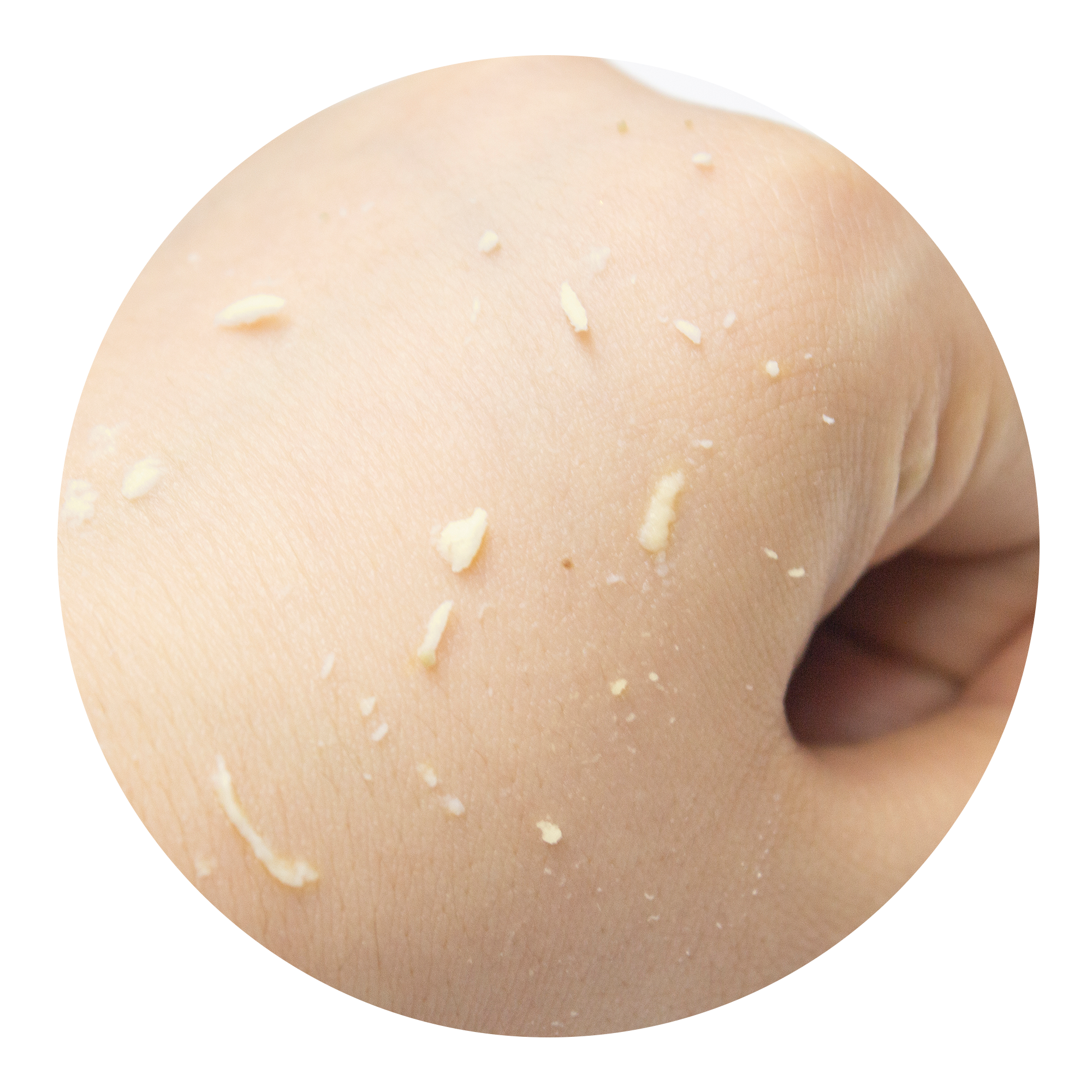 SUR.MEDIC+ DEEP CLEAR BRIGHT CALMING PEELING GEL 4.06 oz / 120ml